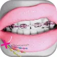 Braces PHoto Editor