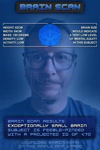 تصاویر Brain Scan!