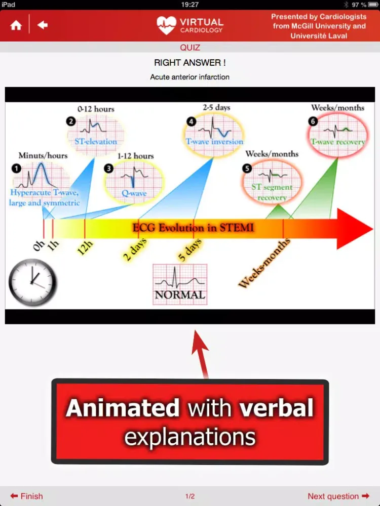 تصاویر Virtual Cardiology by McGill University cardiologists and cardiologists from‎ Université Laval iPad 