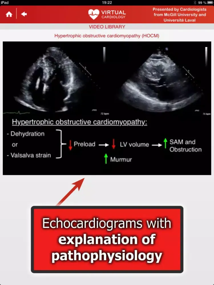 تصاویر Virtual Cardiology by McGill University cardiologists and cardiologists from‎ Université Laval iPad 