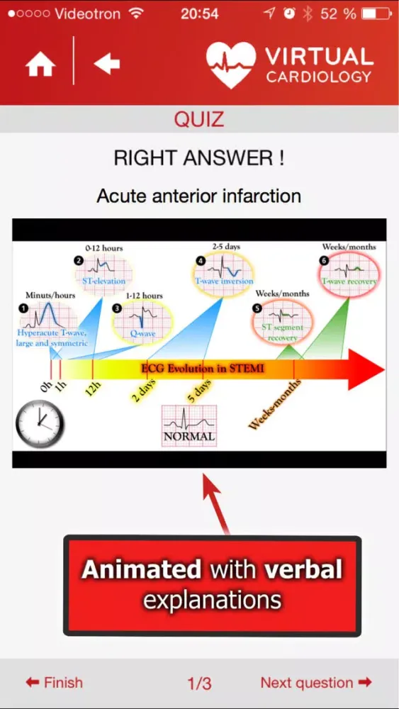 تصاویر Virtual Cardiology by McGill University cardiologists and cardiologists from‎ Université Laval