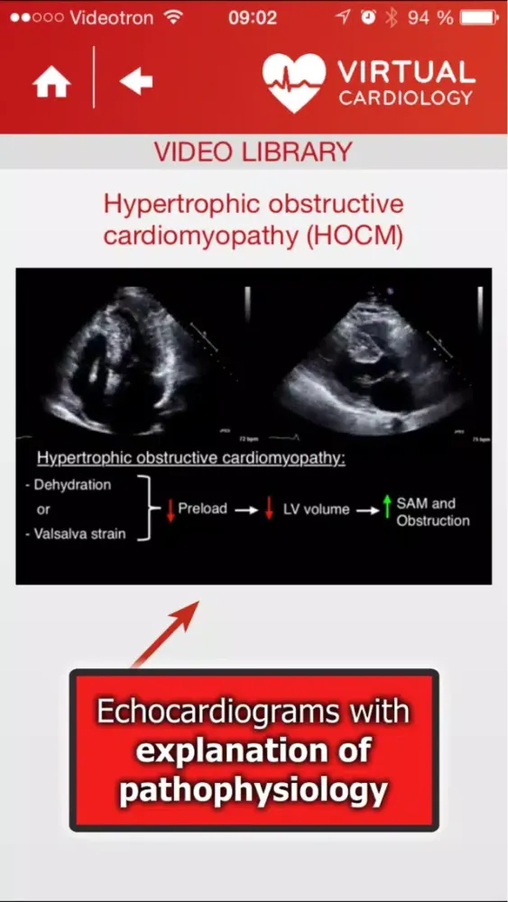 تصاویر Virtual Cardiology by McGill University cardiologists and cardiologists from‎ Université Laval