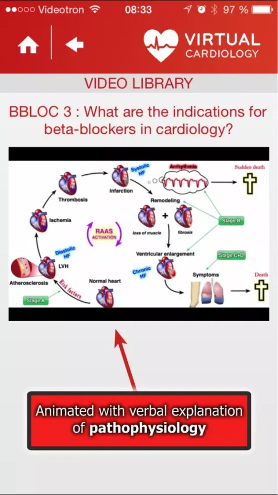 تصاویر Virtual Cardiology by McGill University cardiologists and cardiologists from‎ Université Laval