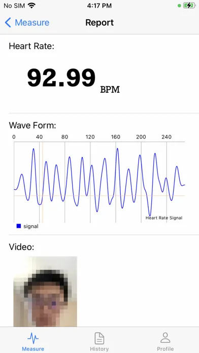 Zrzuty ekranu Remote Vital Signs