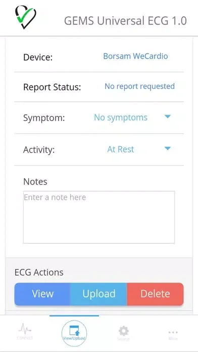 GEMS Universal ECG Ekran Görüntüleri