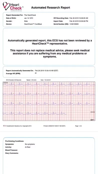 GEMS Universal ECG Ekran Görüntüleri