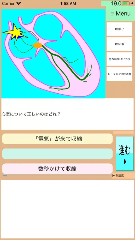 Screenshot di ドクターアニメ:今さら聞けない何ちゃって心電図2:新人レベル