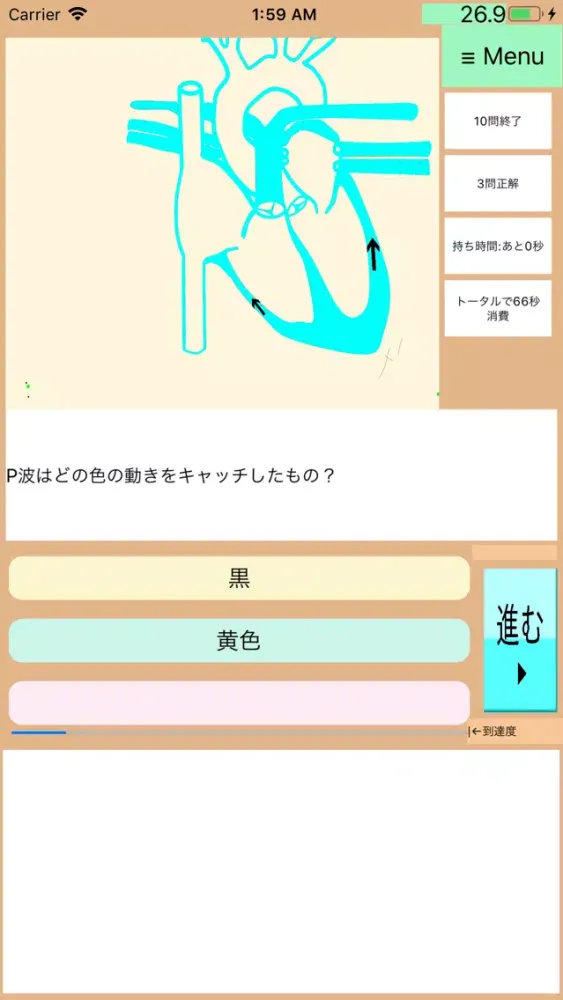 Screenshot di ドクターアニメ:今さら聞けない何ちゃって心電図2:新人レベル