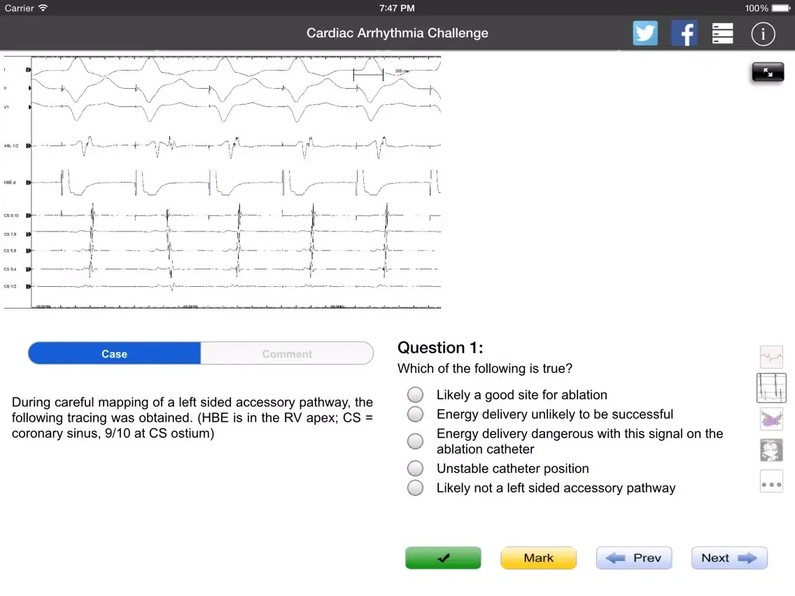 صور Cardiac Arrhythmia Challenge PRO iPad 