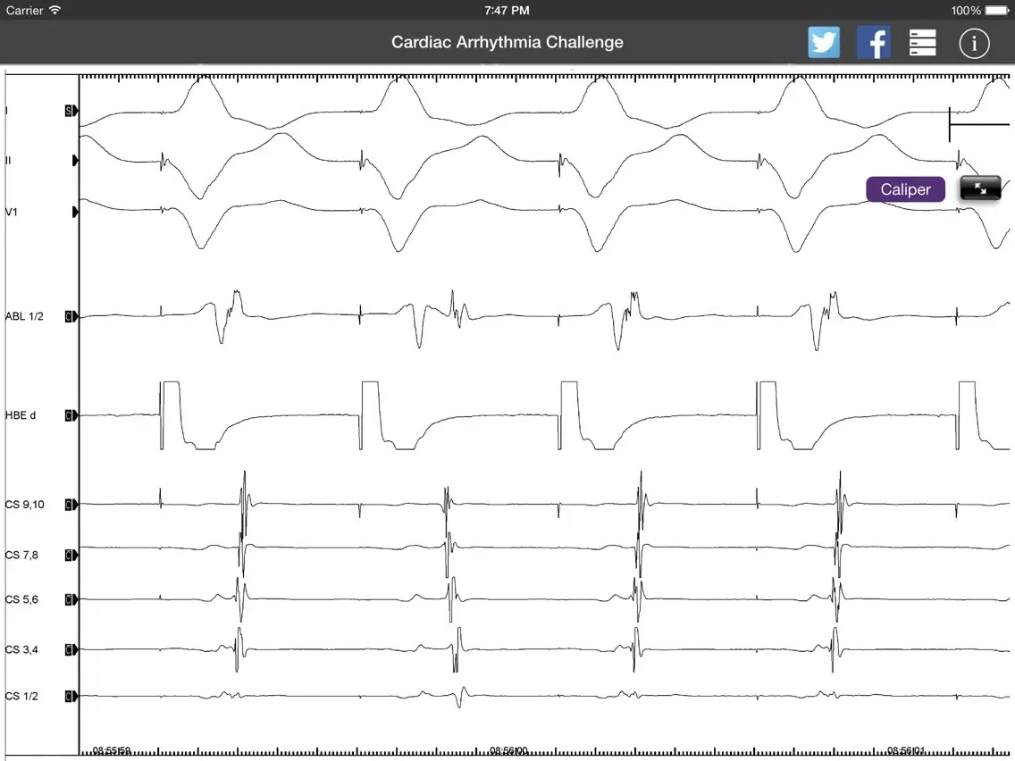 صور Cardiac Arrhythmia Challenge PRO iPad 