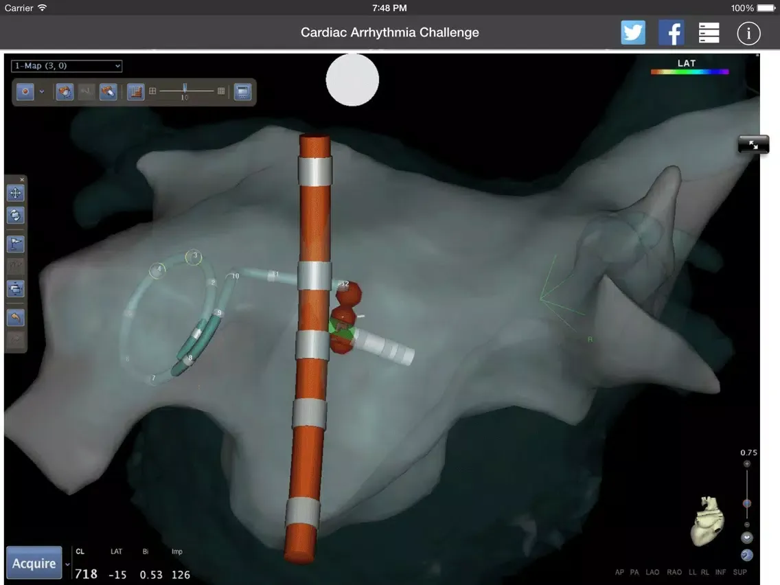 صور Cardiac Arrhythmia Challenge PRO iPad 