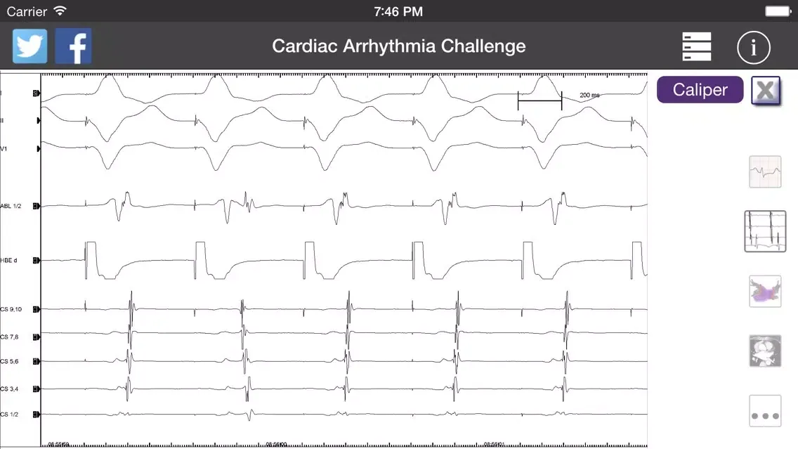 صور Cardiac Arrhythmia Challenge PRO