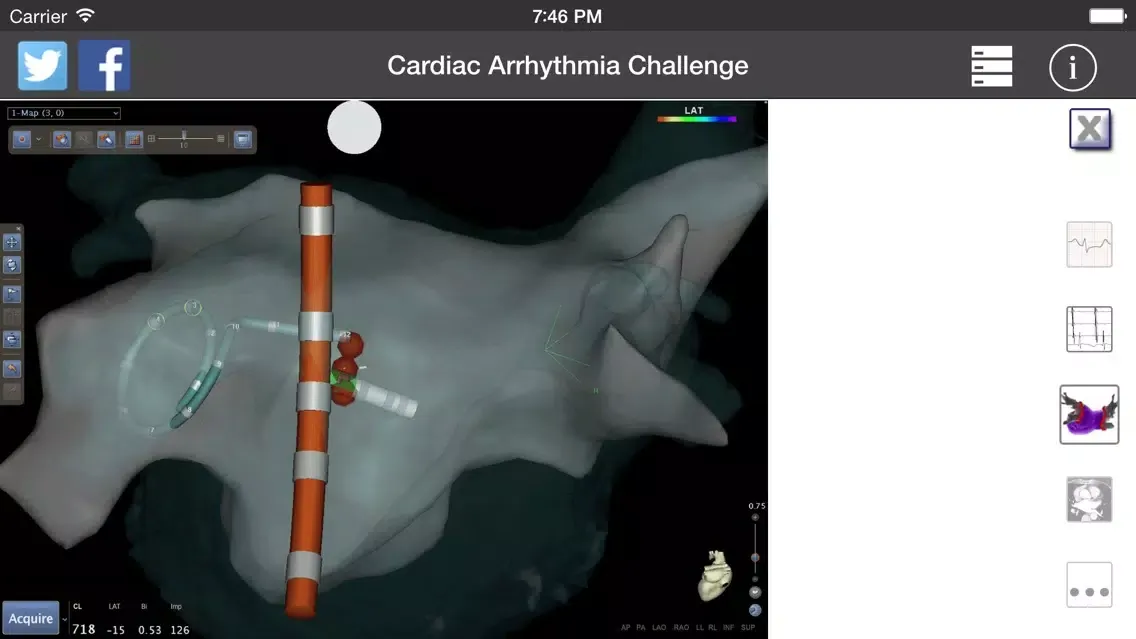 صور Cardiac Arrhythmia Challenge PRO
