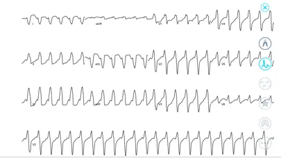صور Cardiac Arrhythmia Challenge