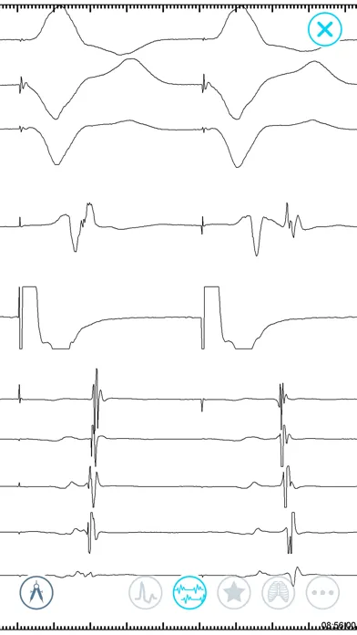 صور Cardiac Arrhythmia Challenge