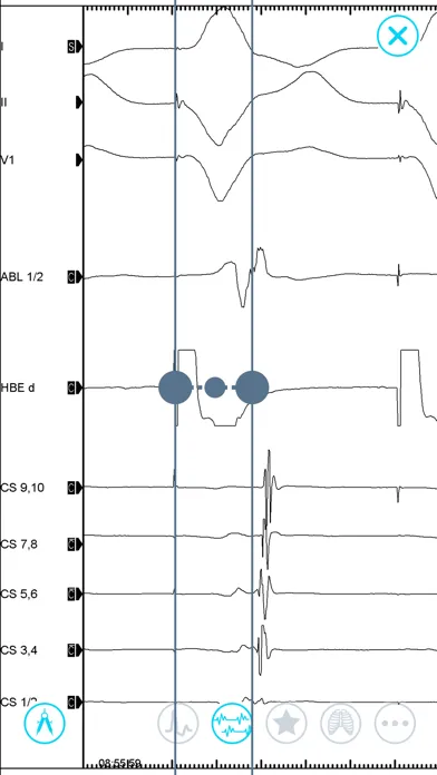 صور Cardiac Arrhythmia Challenge