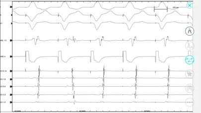 صور Cardiac Arrhythmia Challenge