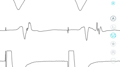صور Cardiac Arrhythmia Challenge