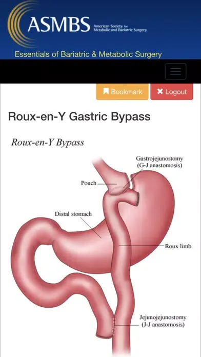ภาพหน้าจอของ Essentials of Bariatric & Metabolic Surgery
