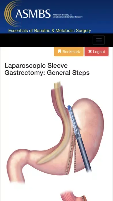ภาพหน้าจอของ Essentials of Bariatric & Metabolic Surgery