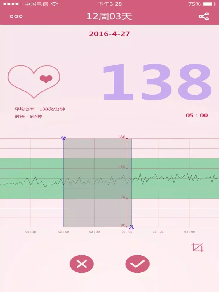 ภาพหน้าจอของ MYWINE fetal DOPPLER iPad 
