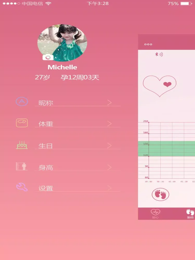 ภาพหน้าจอของ MYWINE fetal DOPPLER iPad 