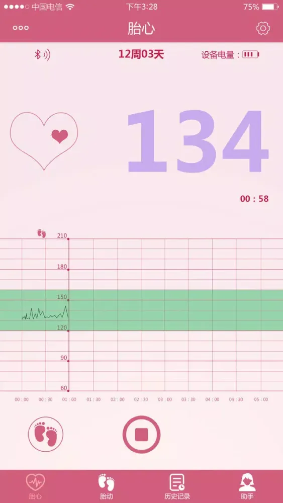 ภาพหน้าจอของ MYWINE fetal DOPPLER