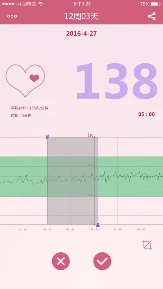 ภาพหน้าจอของ MYWINE fetal DOPPLER