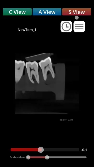 Capturas de pantalla de Zumax Dicom Viewer - CN