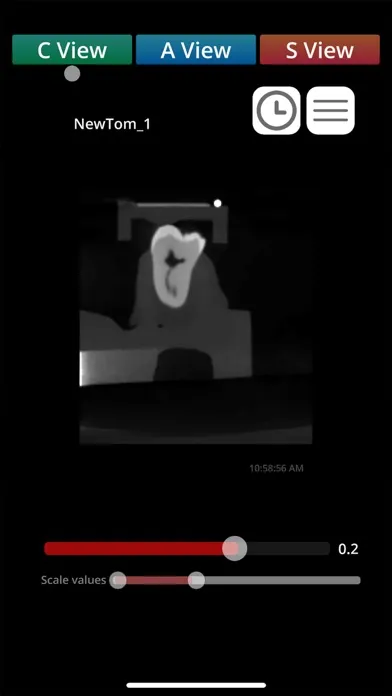 Capturas de pantalla de Zumax Dicom Viewer - CN
