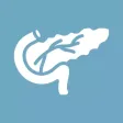 Glasgow Pancreatitis Score Glasgow Pancreatitis Score