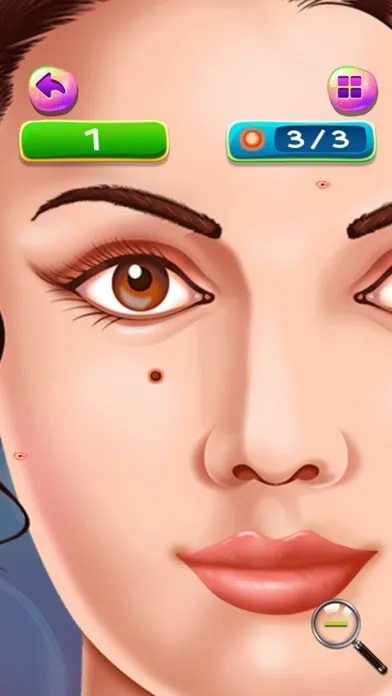Pimples and Blackheads Removal : get rid of pimples from nose and face ! FREE Screenshots