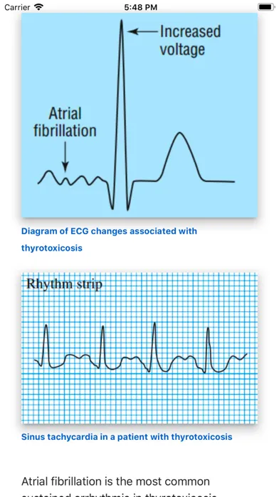 ECG Basics Lite: ECG Made Easy应用截图