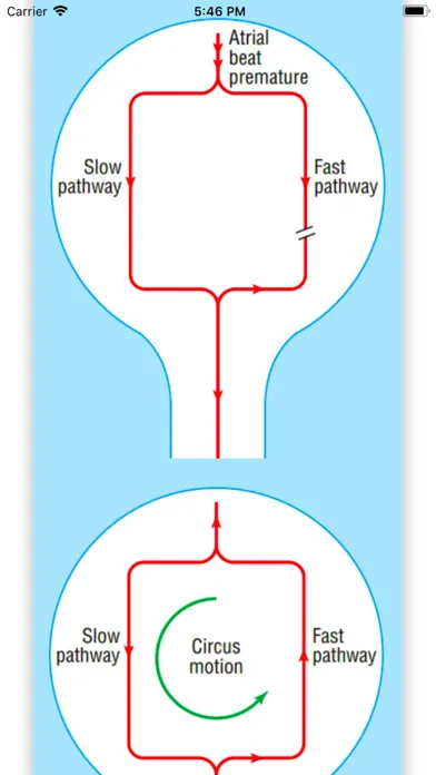 ECG Basics Lite: ECG Made Easy应用截图
