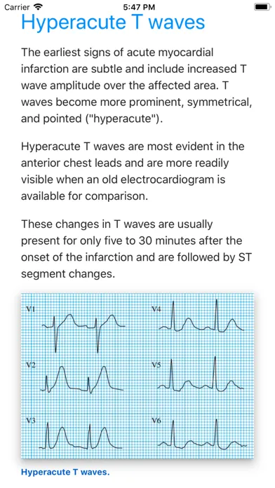 ECG Basics Lite: ECG Made Easy应用截图