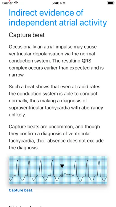 ECG Basics Lite: ECG Made Easy应用截图