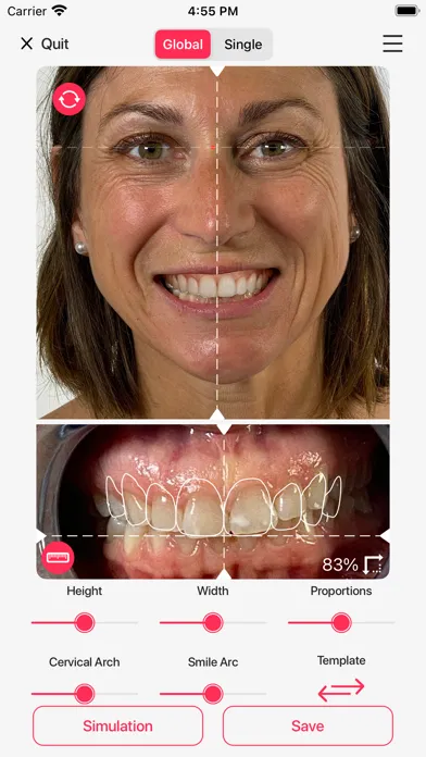 ภาพหน้าจอของ Hybridge Smile Design