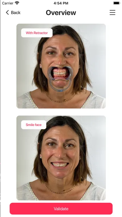 ภาพหน้าจอของ Hybridge Smile Design