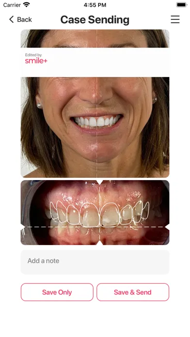 ภาพหน้าจอของ Hybridge Smile Design