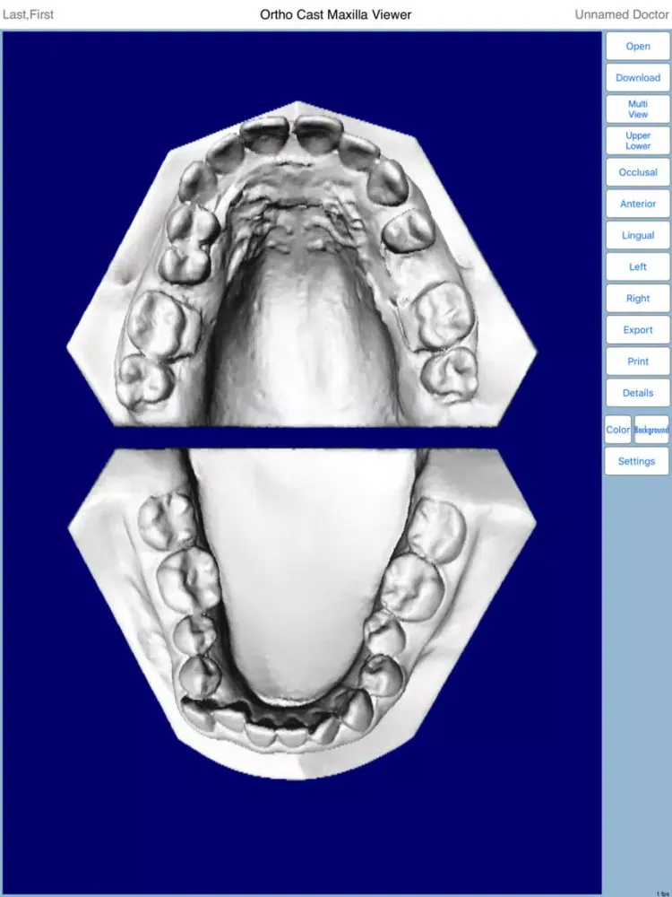 Maxilla iPad  स्क्रीनशॉट