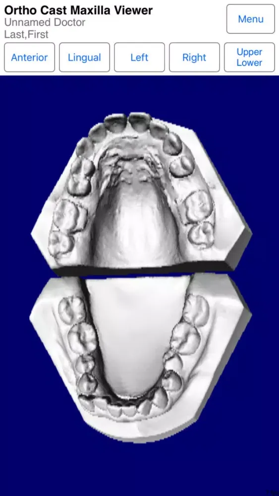 Maxilla स्क्रीनशॉट