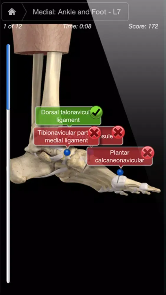 Captures d'écran de Ankle & Foot Pro III