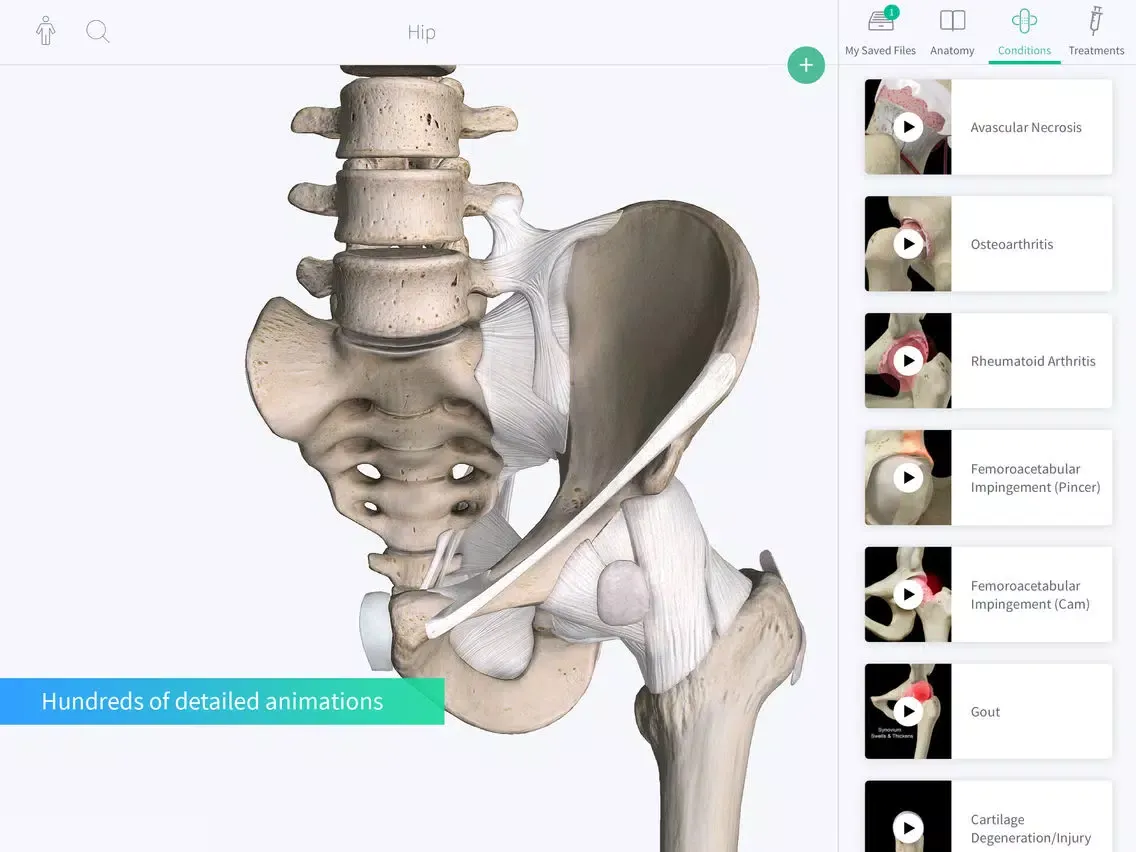 Complete Ortho iPad 应用截图
