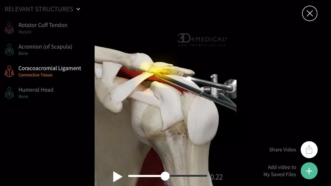 Complete Ortho应用截图