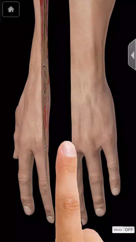 Capturas de pantalla de Hand & Wrist Pro III