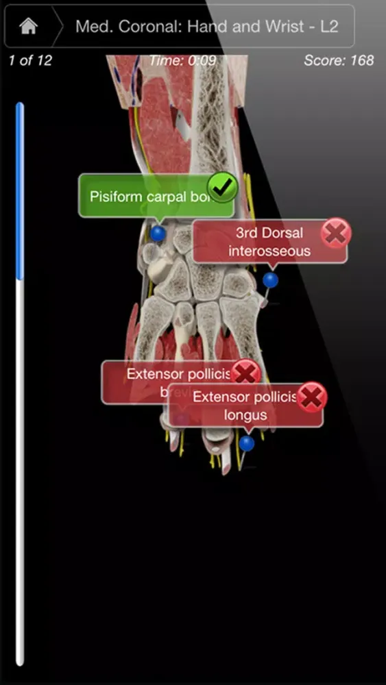 Capturas de pantalla de Hand & Wrist Pro III