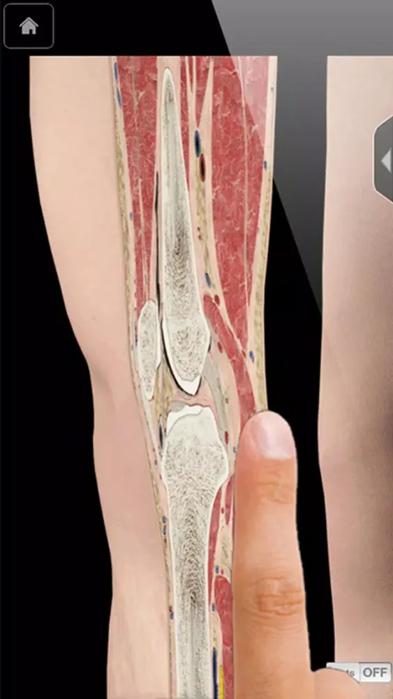 Knee Pro III Ekran Görüntüleri