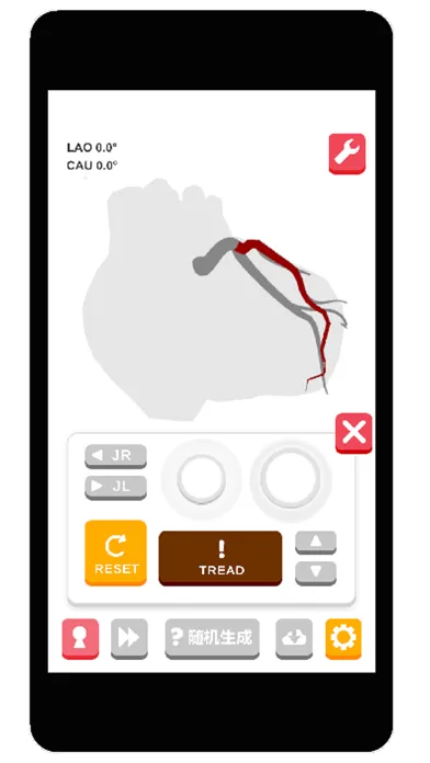 Coronary Angiography Simulator سکرین شاٹس