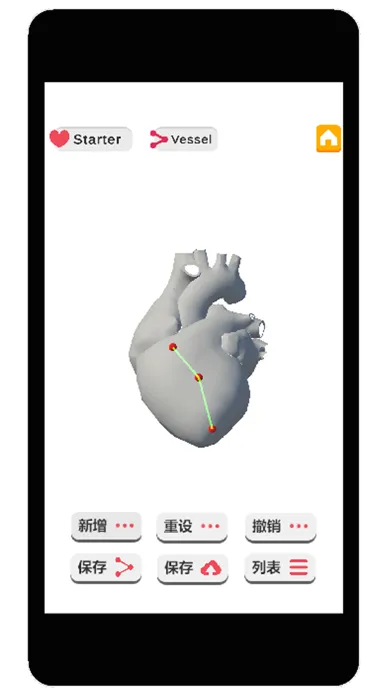 Coronary Angiography Simulator سکرین شاٹس