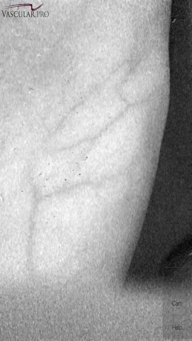 Vein Camera Screenshots